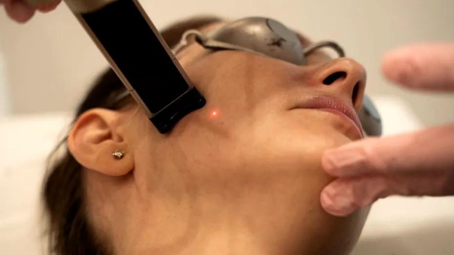 Lifting fără bisturiu: tratamentul cu recuperare rapidă pe care tot mai multe femei îl aleg în sezonul rece