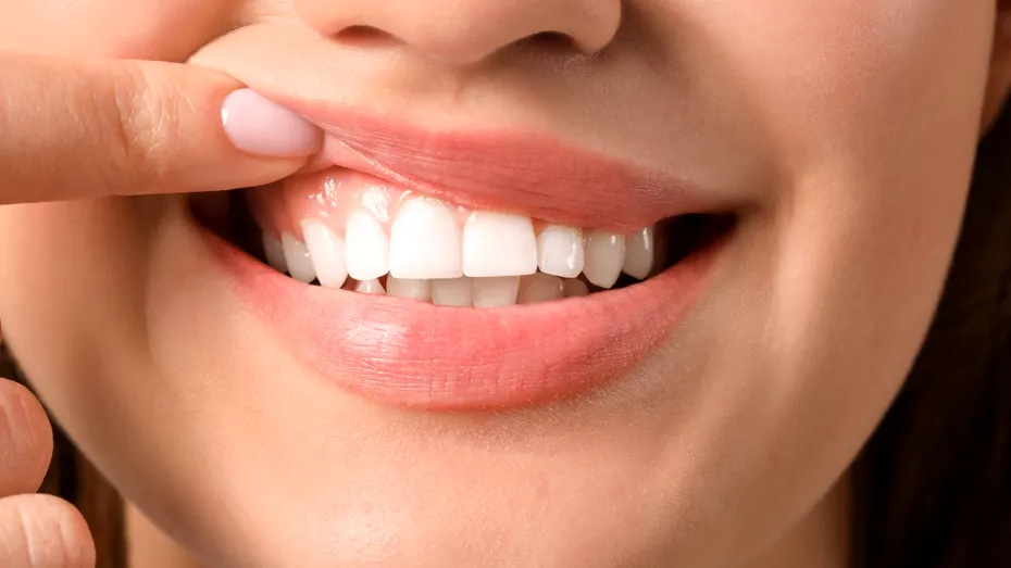 Trucul simplu pentru dinți mai albi acasă. Ingredientul banal care îți poate transforma zâmbetul